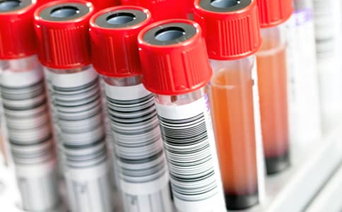 化驗室試劑領用管理新改革